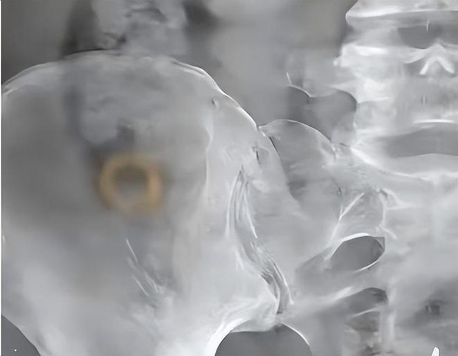 女子把100克黄金当垃圾扔了急哭 查监控发现被人捡走